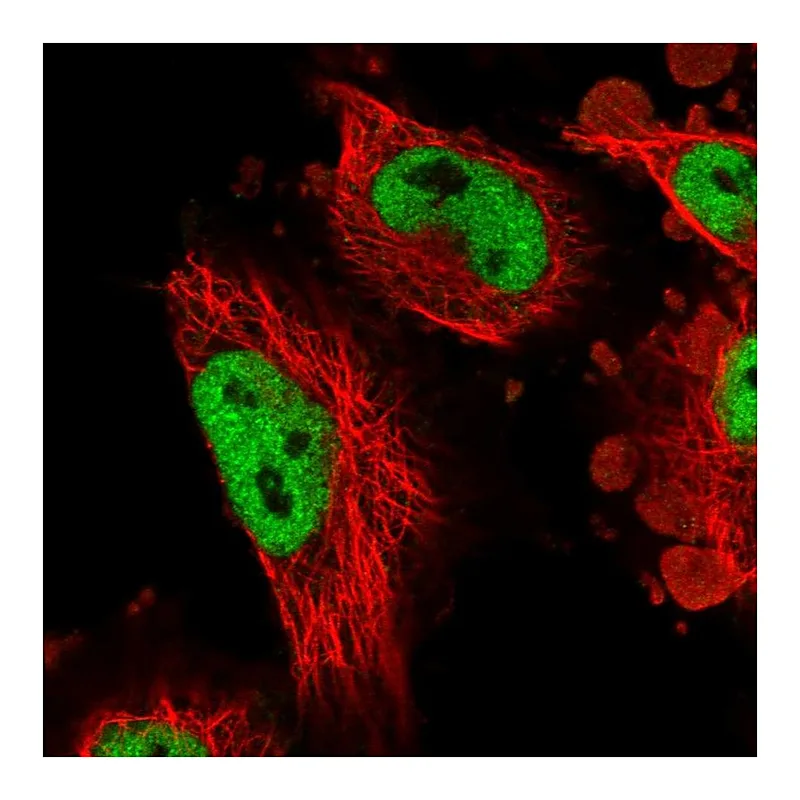 Atlas Antibodies Anti-ATN1 Antibody