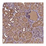 Atlas Antibodies Anti-ATP10A Antibody