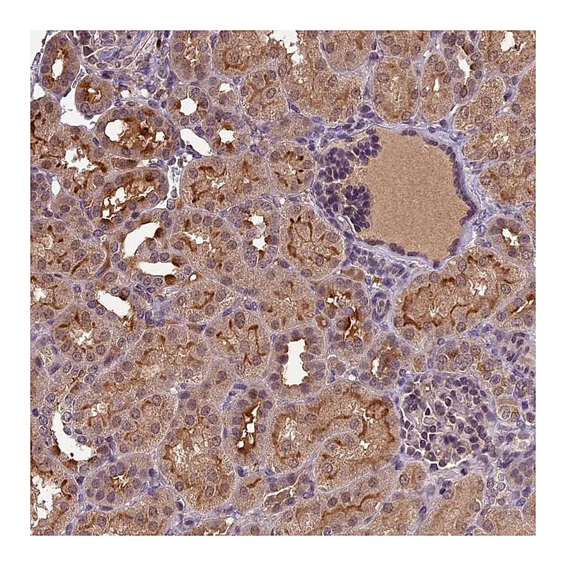 Atlas Antibodies Anti-ATP10A Antibody
