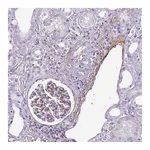 Atlas Antibodies Anti-ATP10A Antibody
