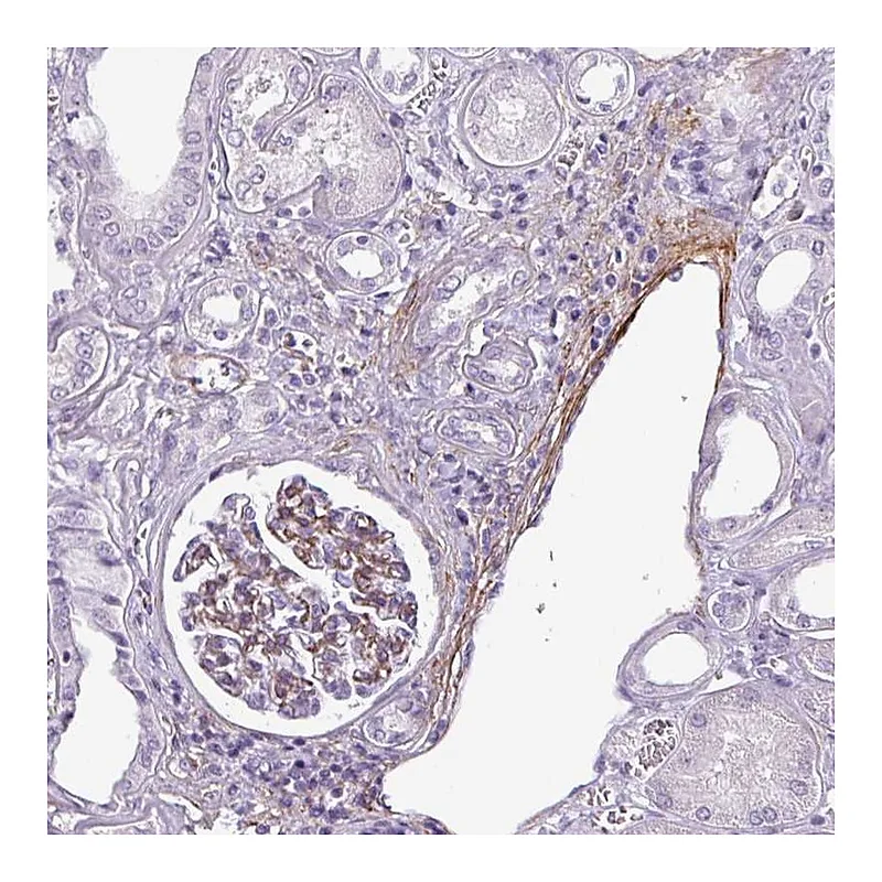 Atlas Antibodies Anti-ATP10A Antibody