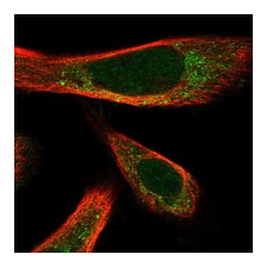 Atlas Antibodies Anti-ATOH1 Antibody
