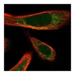 Atlas Antibodies Anti-ATOH1 Antibody