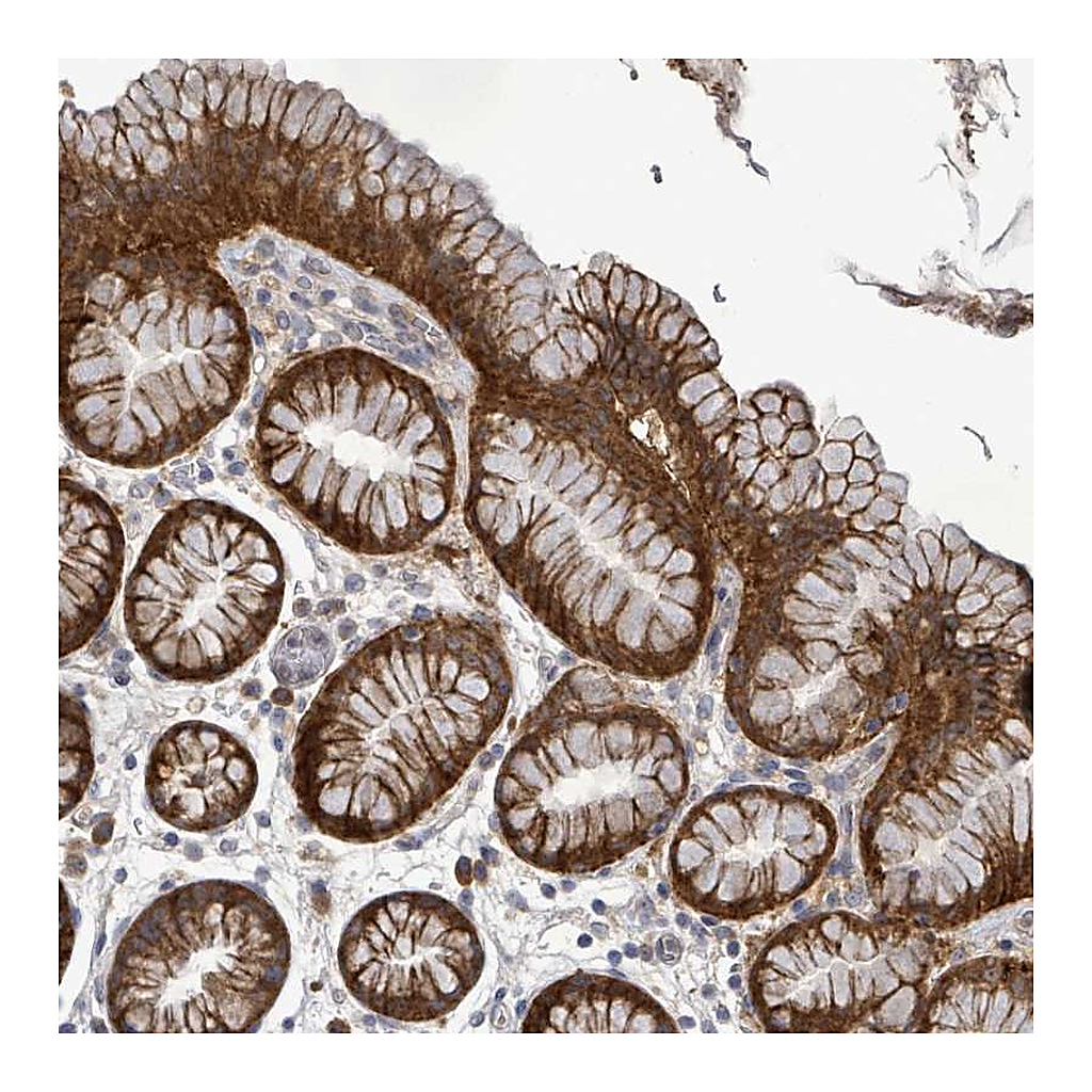 Atlas Antibodies Anti-ATP13A1 Antibody