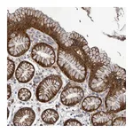 Atlas Antibodies Anti-ATP13A1 Antibody