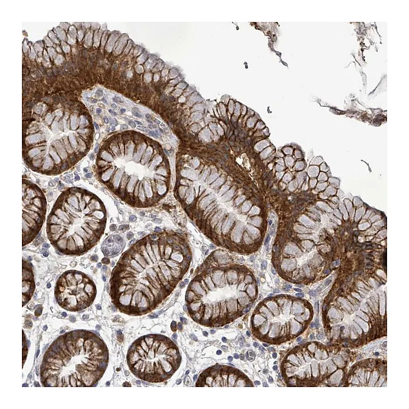 Atlas Antibodies Anti-ATP13A1 Antibody