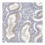 Atlas Antibodies Anti-ATP11A Antibody