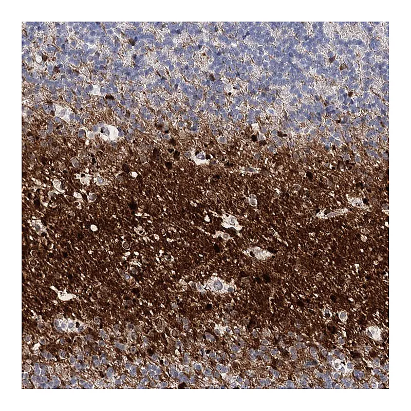 Atlas Antibodies Anti-ATP10B Antibody