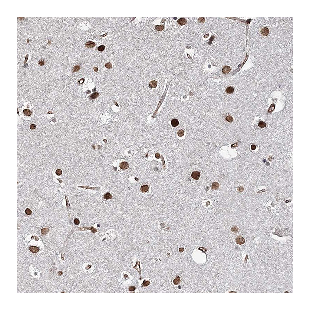 Atlas Antibodies Anti-ATP11B Antibody