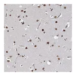 Atlas Antibodies Anti-ATP11B Antibody