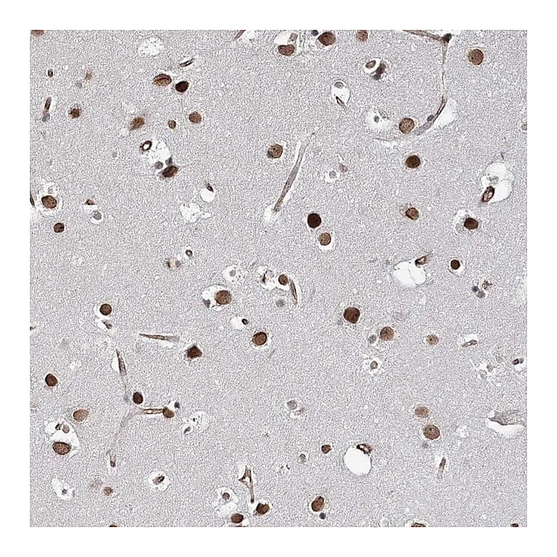 Atlas Antibodies Anti-ATP11B Antibody