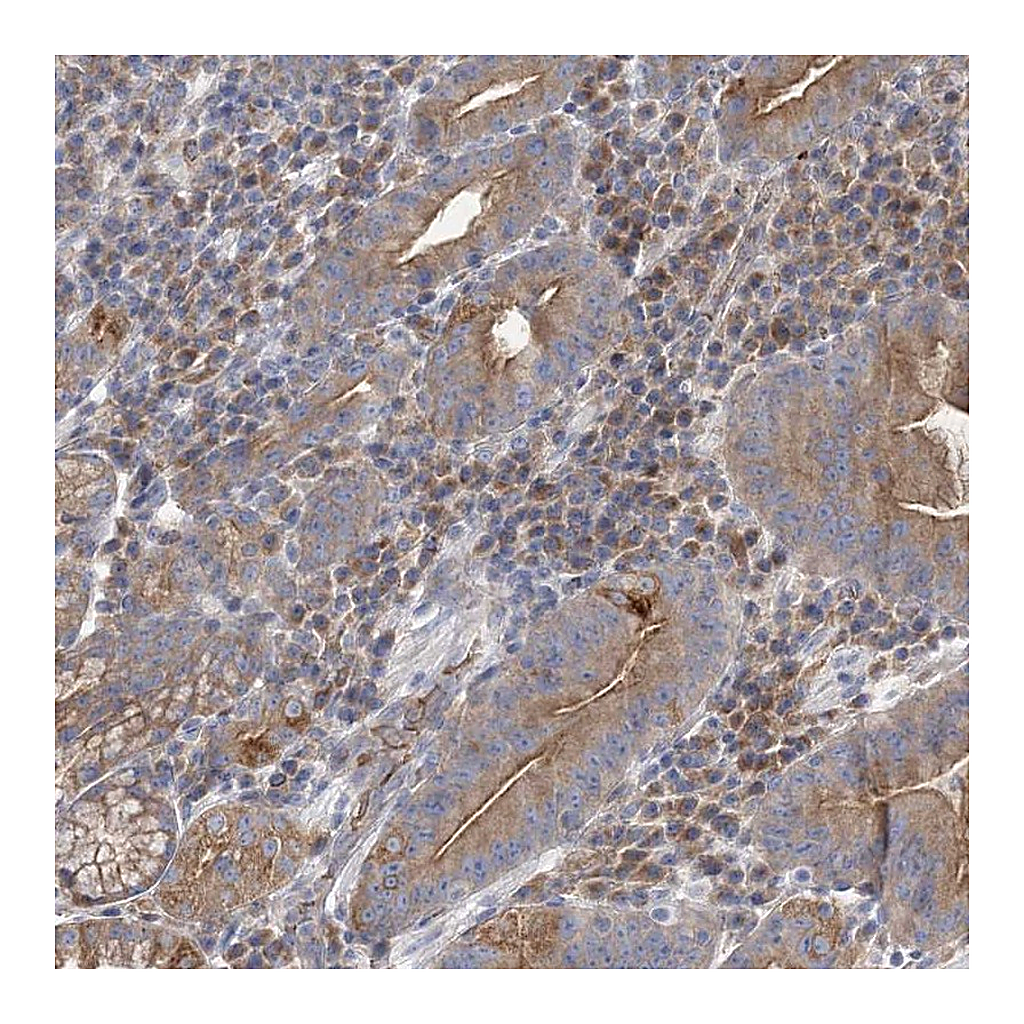 Atlas Antibodies Anti-ATP11B Antibody