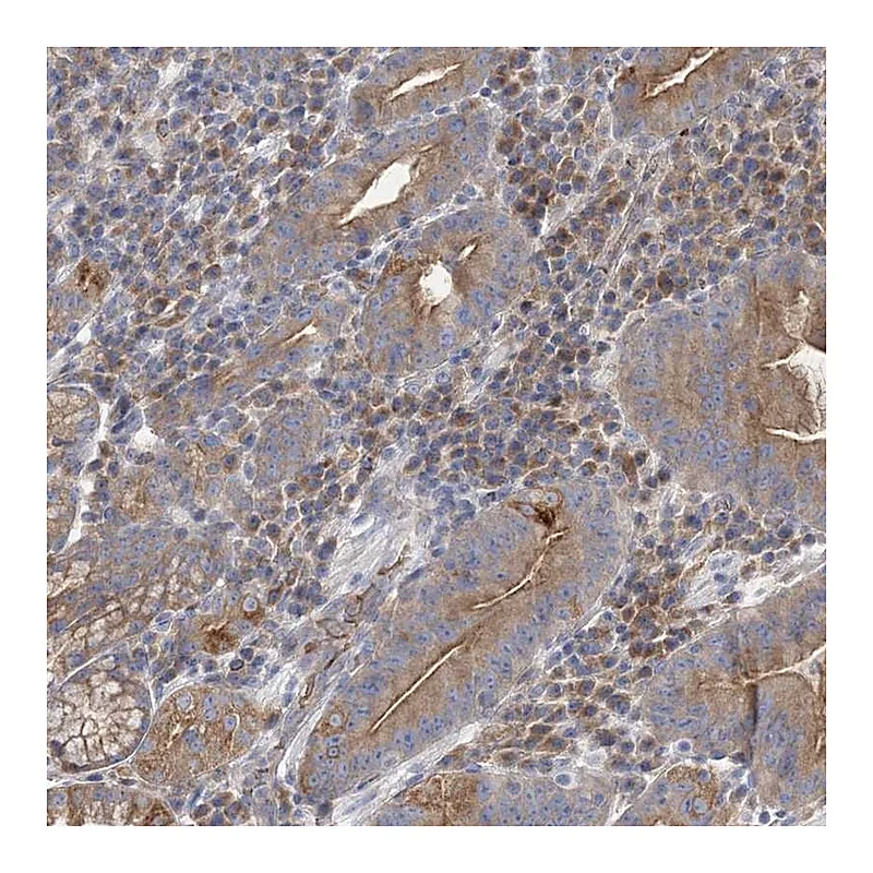 Atlas Antibodies Anti-ATP11B Antibody