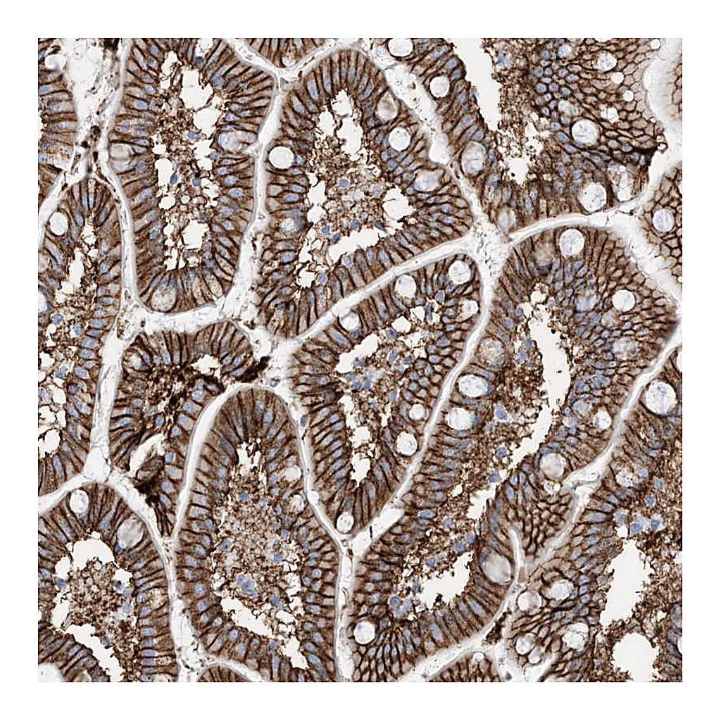 Atlas Antibodies Anti-ATP11C Antibody