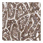 Atlas Antibodies Anti-ATP11C Antibody