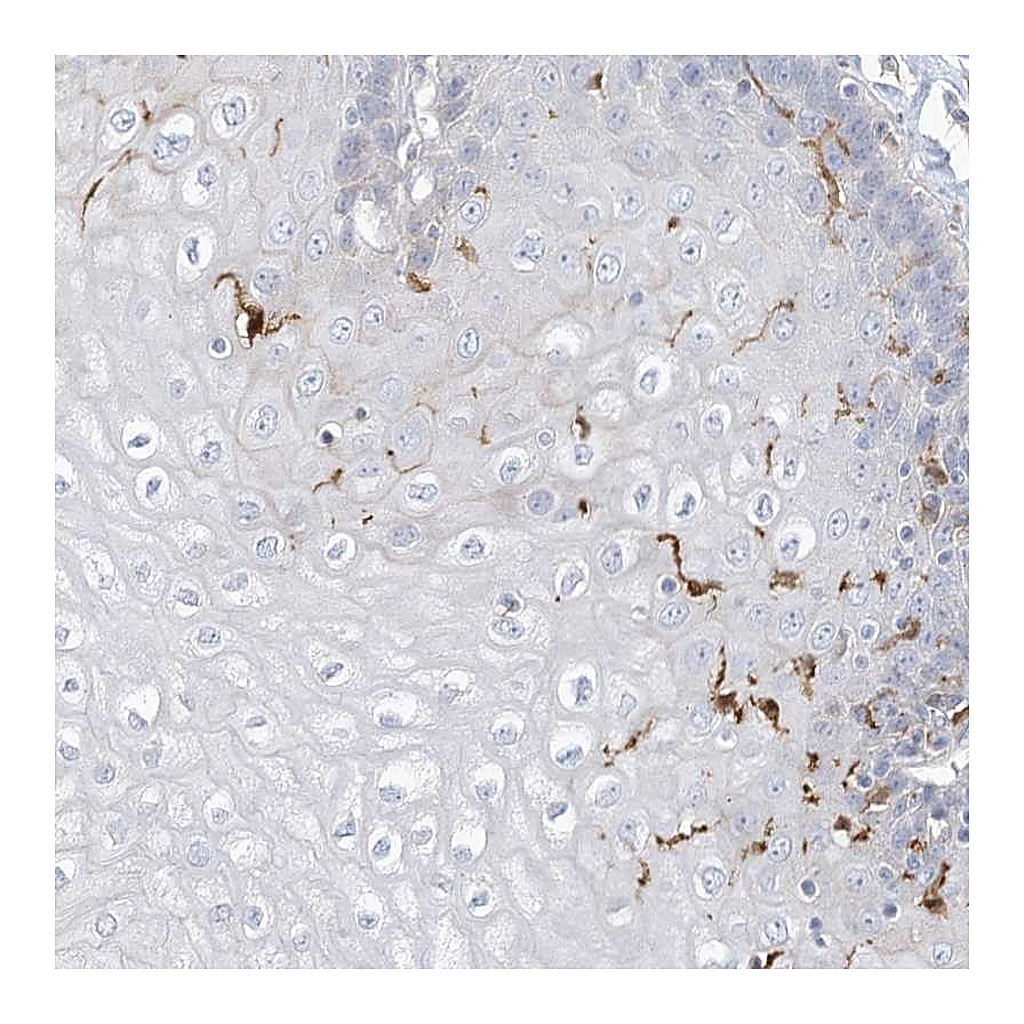 Atlas Antibodies Anti-ATP13A1 Antibody