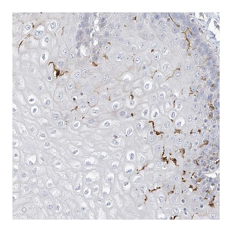 Atlas Antibodies Anti-ATP13A1 Antibody