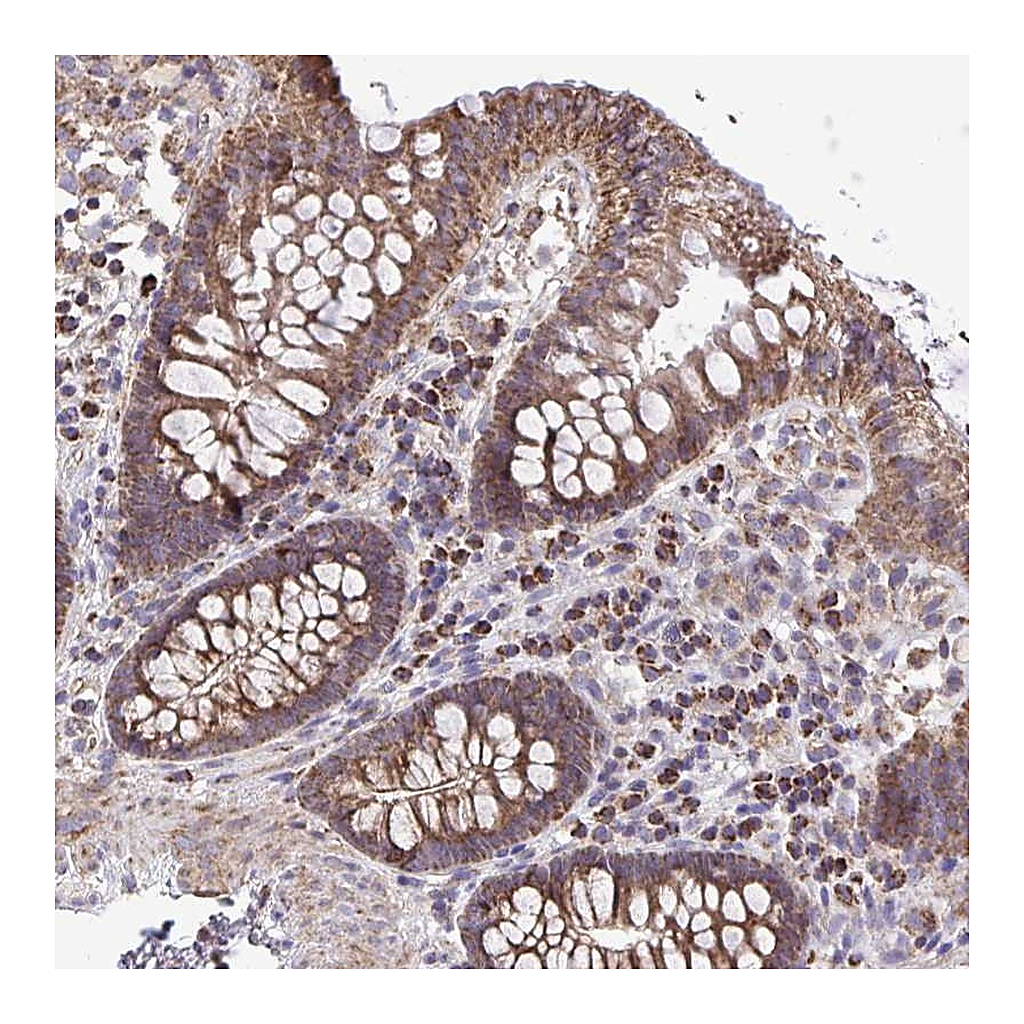 Atlas Antibodies Anti-ATP13A2 Antibody