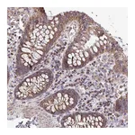 Atlas Antibodies Anti-ATP13A2 Antibody