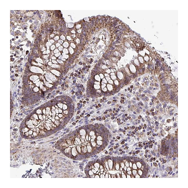 Atlas Antibodies Anti-ATP13A2 Antibody
