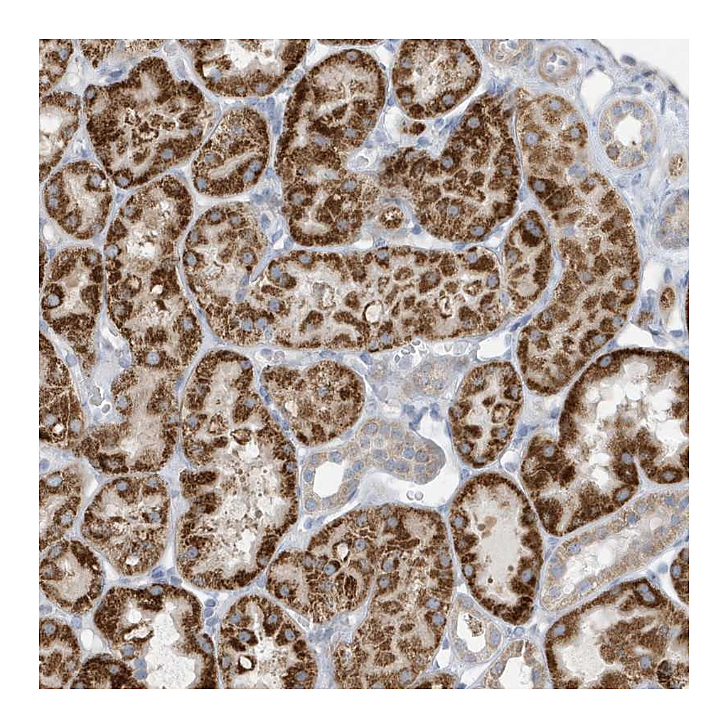 Atlas Antibodies Anti-ATP13A5 Antibody