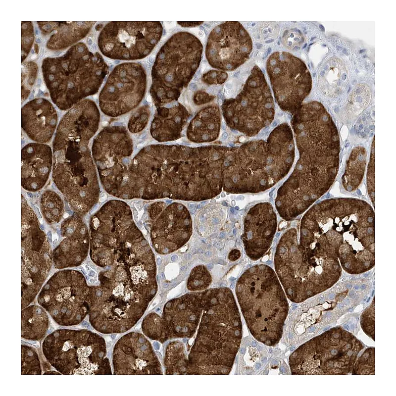 Atlas Antibodies Anti-ATP13A5 Antibody
