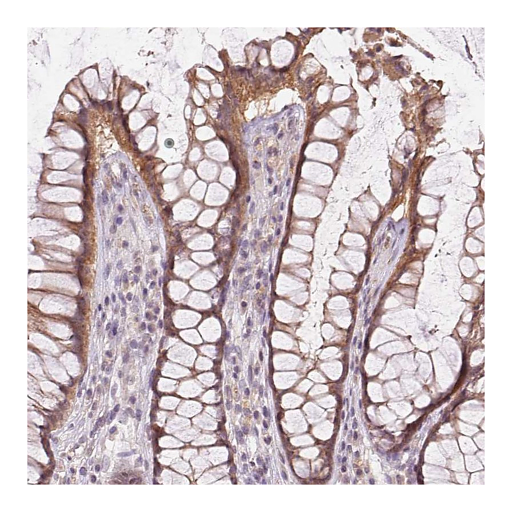 Atlas Antibodies Anti-ATP1B3 Antibody