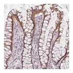 Atlas Antibodies Anti-ATP1B3 Antibody