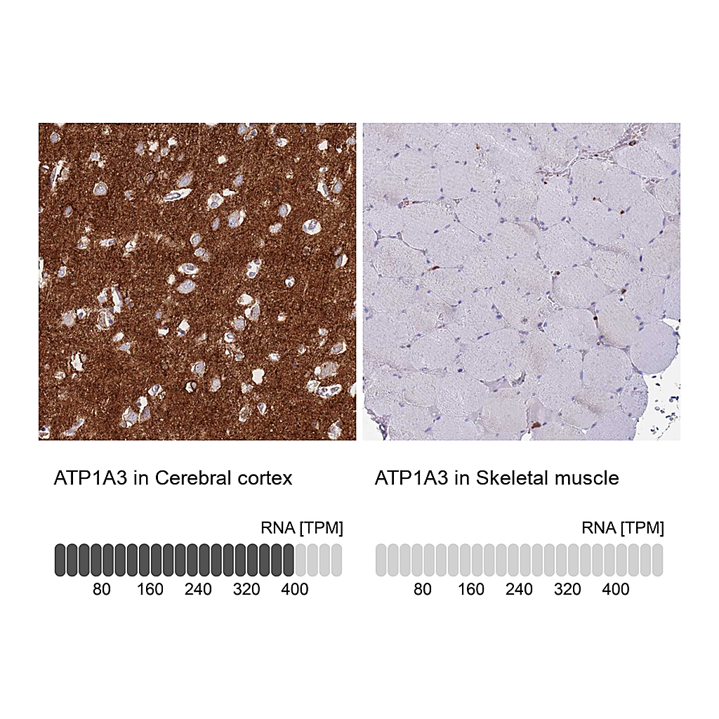 Atlas Antibodies Anti-ATP1A3 Antibody
