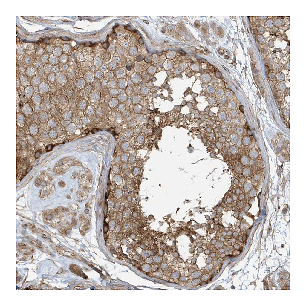 Atlas Antibodies Anti-ATP23 Antibody