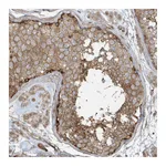 Atlas Antibodies Anti-ATP23 Antibody