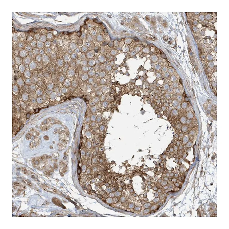 Atlas Antibodies Anti-ATP23 Antibody