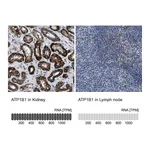 Atlas Antibodies Anti-ATP1B1 Antibody