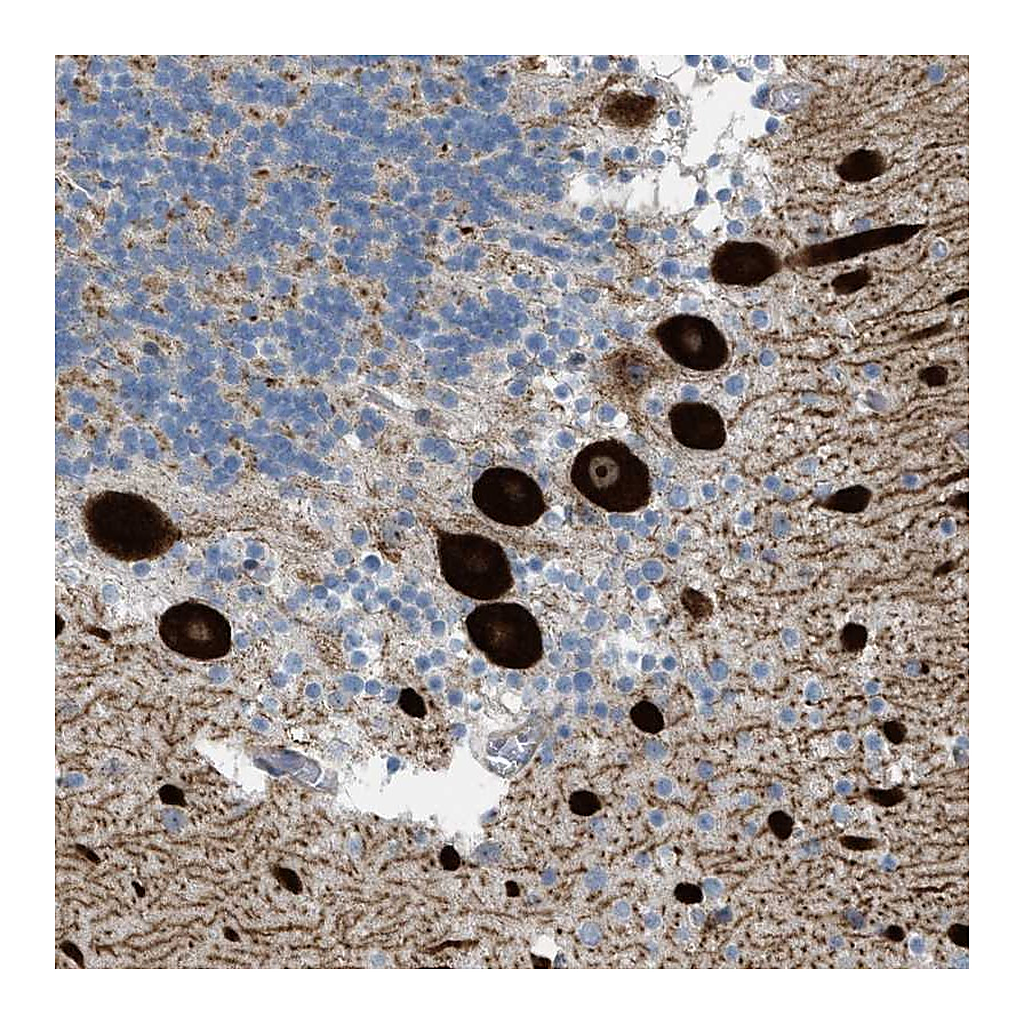Atlas Antibodies Anti-ATP2A3 Antibody