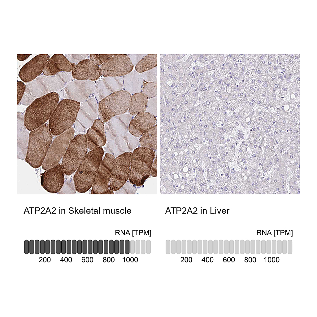 Atlas Antibodies Anti-ATP2A2 Antibody