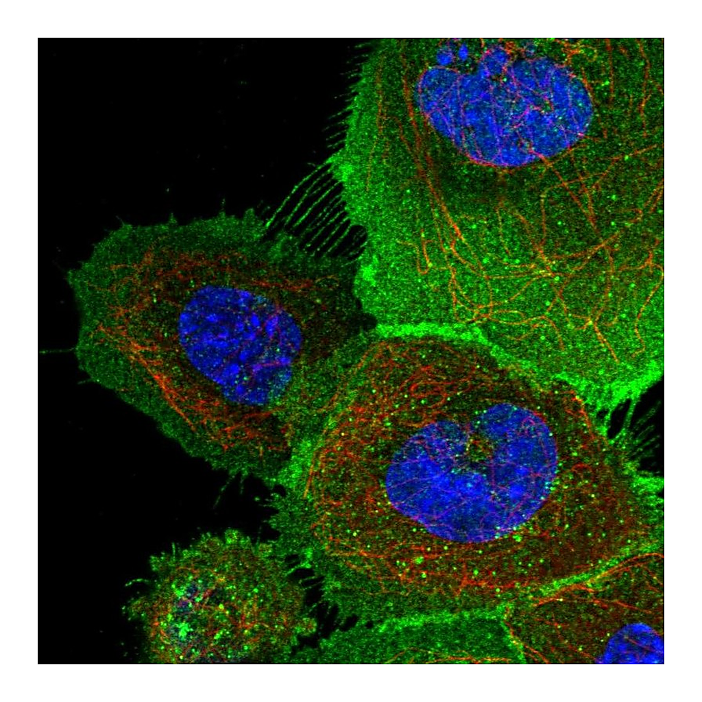 Atlas Antibodies Anti-ATP23 Antibody