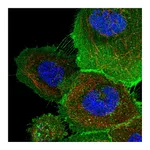 Atlas Antibodies Anti-ATP23 Antibody