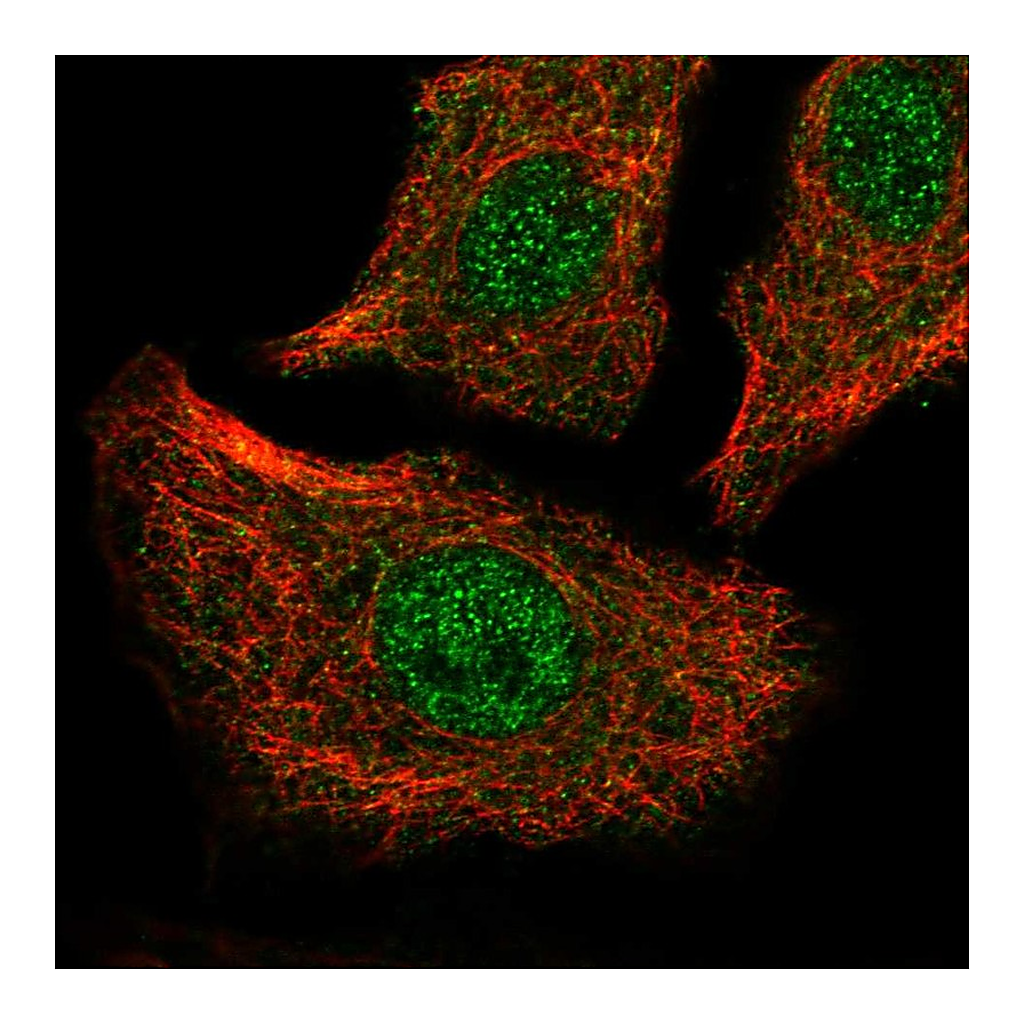 Atlas Antibodies Anti-ATP2A2 Antibody