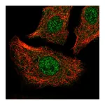 Atlas Antibodies Anti-ATP2A2 Antibody