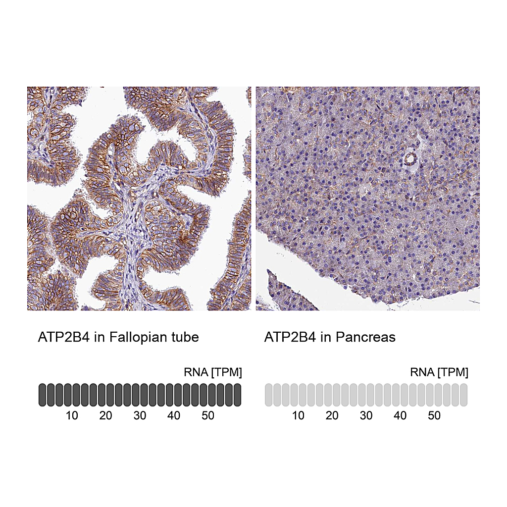 Atlas Antibodies Anti-ATP2B4 Antibody