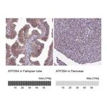 Atlas Antibodies Anti-ATP2B4 Antibody