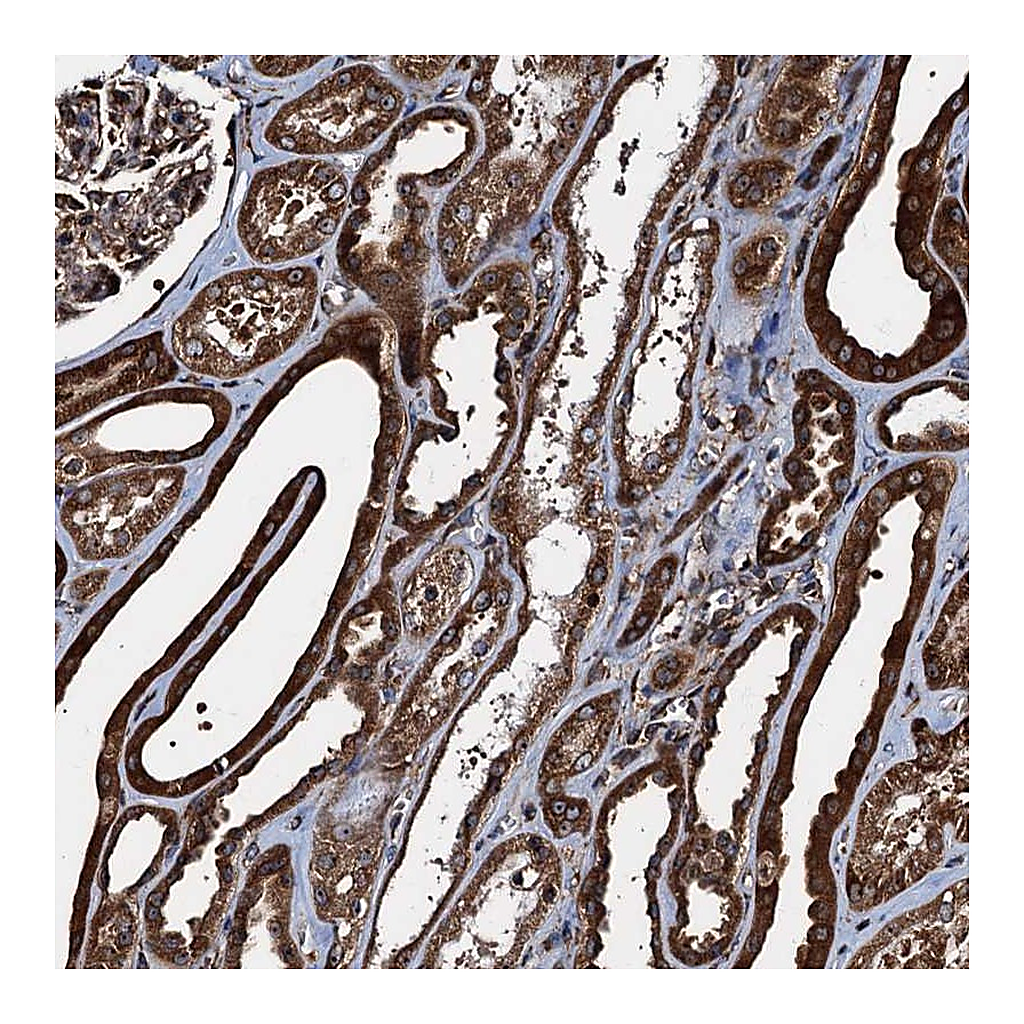 Atlas Antibodies Anti-ATP2C1 Antibody