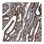 Atlas Antibodies Anti-ATP2C1 Antibody
