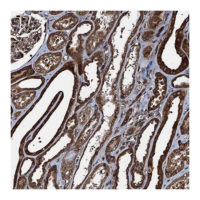 Atlas Antibodies Anti-ATP2C1 Antibody