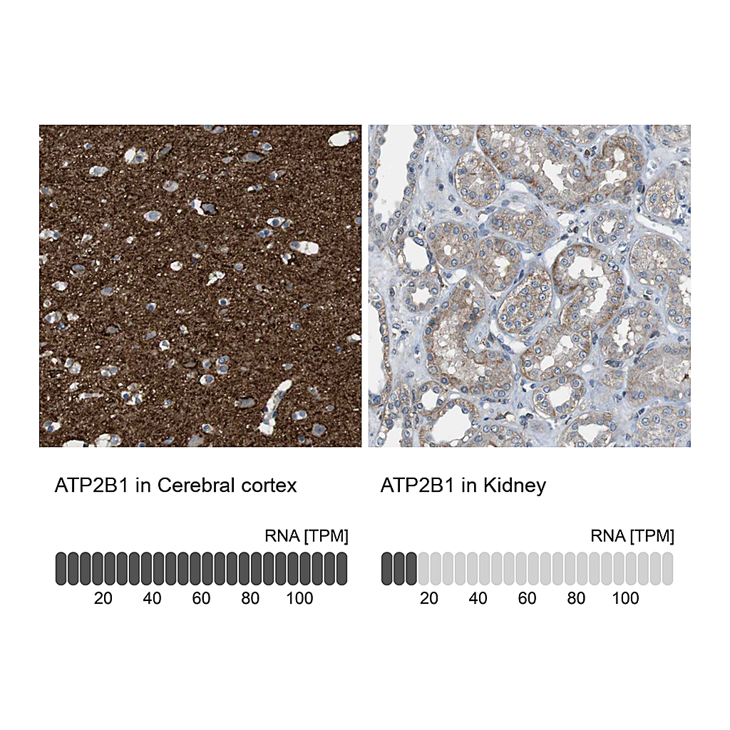 Atlas Antibodies Anti-ATP2B1 Antibody
