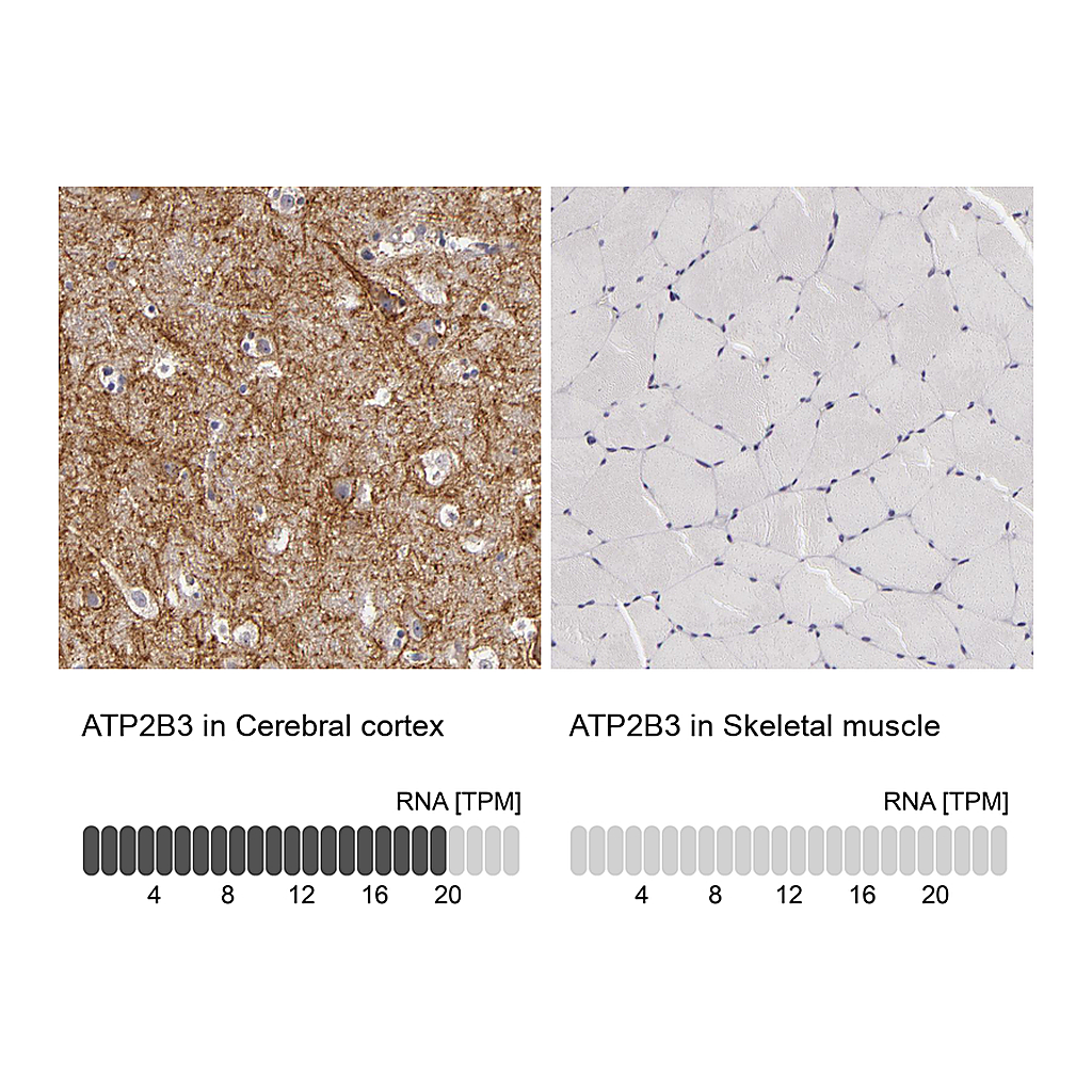 Atlas Antibodies Anti-ATP2B3 Antibody