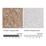 Atlas Antibodies Anti-ATP2B3 Antibody