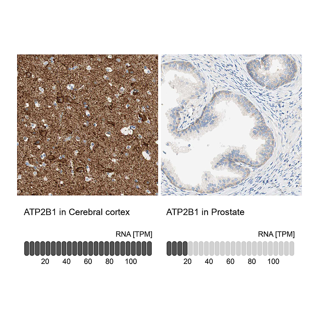 Atlas Antibodies Anti-ATP2B1 Antibody