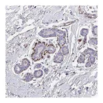 Atlas Antibodies Anti-ATP2C2 Antibody