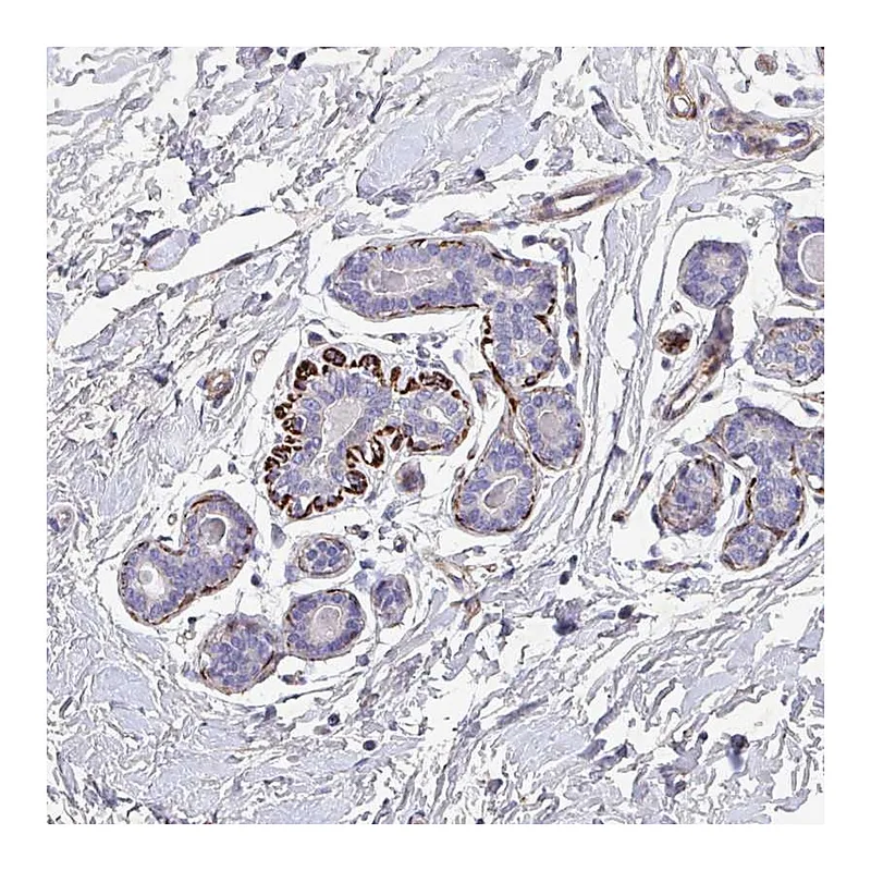 Atlas Antibodies Anti-ATP2C2 Antibody